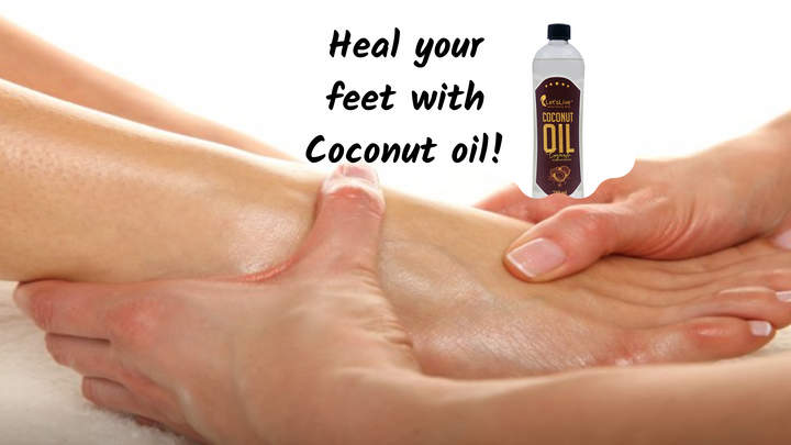 Heal your feet with Coconut oil!
