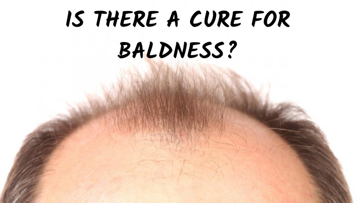 Is there a cure for Baldness?
