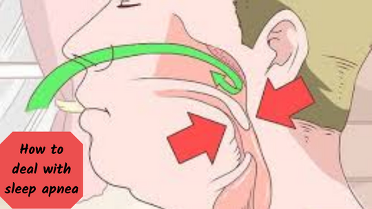 How to deal with sleep apnea